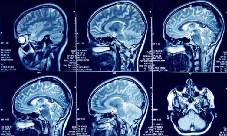 Unveiling the Diagnostic Power of MRI: Detecting a Spectrum of Diseases